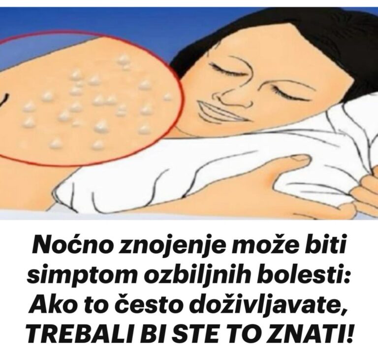 Noćno znojenje može biti simptom ozbiljnih bolesti: Ako to često doživljavate, TREBALI BI STE TO ZNATI!