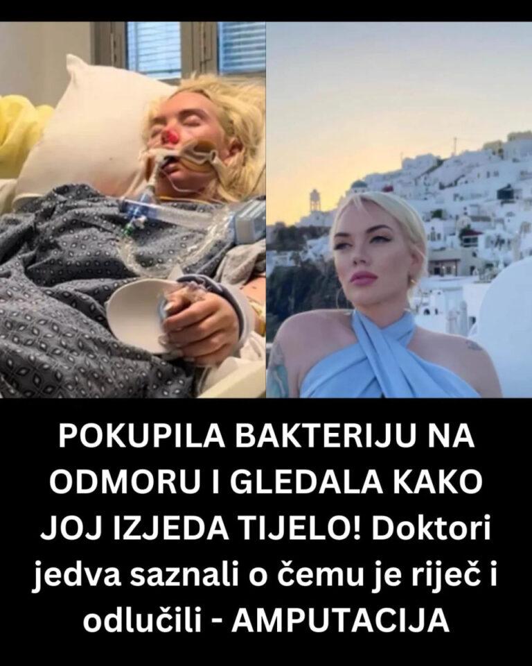 POKUPILA BAKTERIJU NA ODMORU I GLEDALA KAKO JOJ IZJEDA TIJELO! Doktori jedva saznali o čemu je riječ i odlučili – AMPUTACIJA