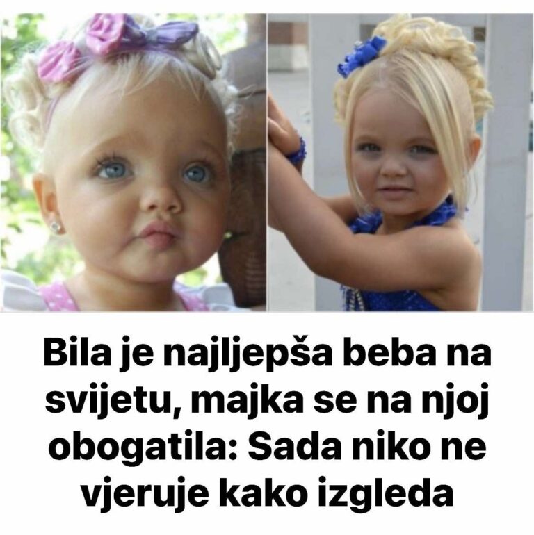 Bila je najljepša beba na svijetu, majka se na njoj obogatila: Sada niko ne vjeruje kako izgleda