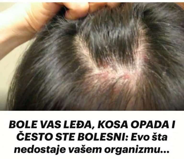 BOLE VAS LEĐA, KOSA OPADA I ČESTO STE BOLESNI: Evo šta nedostaje vašem organizmu