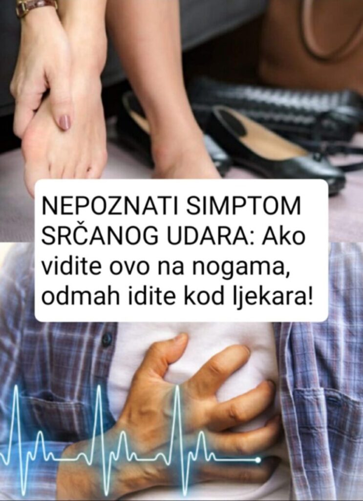 NEPOZNATI SIMPTOM SRČANOG UDARA: Ako vidite ovo na nogama, odmah idite kod ljekara!