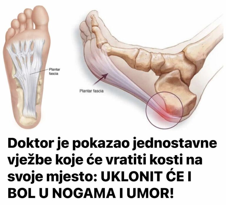 Doktor je pokazao jednostavne vježbe koje će vratiti kosti na svoje mjesto: UKLONIT ĆE I BOL U NOGAMA I UMOR!