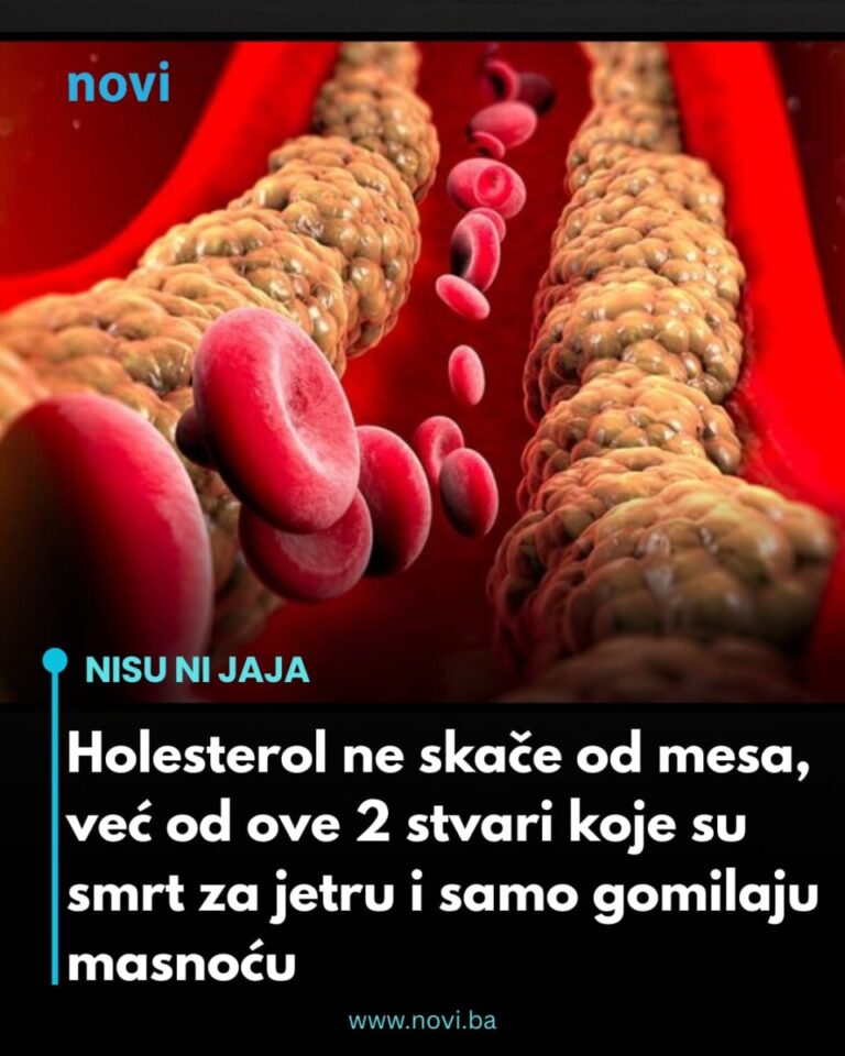 Holesterol ne skače od mesa, već od ove 2 stvari koje su smrt za jetru i samo gomilaju masnoću