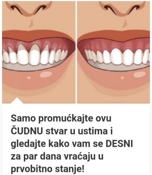 Samo Promućkajte Ovu ČUDNU Stvar U Ustima I Gledajte Kako Vam Se DESNI Za Par Dana Vraćaju U Prvobitno Stanje!