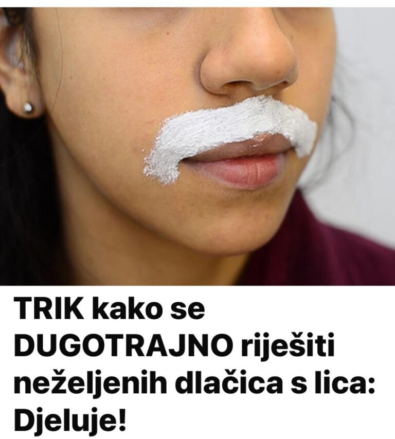 TRIK kako se DUGOTRAJNO riješiti neželjenih dlačica s lica: Djeluje!