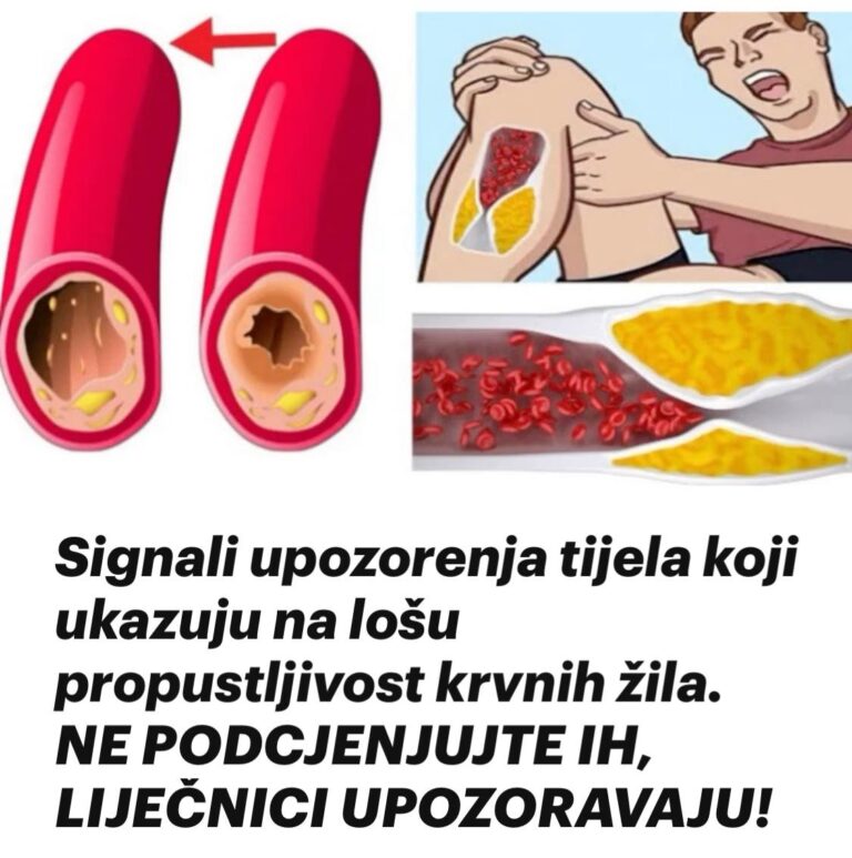 Signali upozorenja tijela koji ukazuju na lošu propustljivost krvnih žila. NE PODCJENJUJTE IH, LIJEČNICI UPOZORAVAJU!