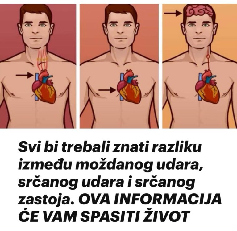 Svi bi trebali znati razliku između moždanog udara, srčanog udara i srčanog zastoja. OVA INFORMACIJA ĆE VAM SPASITI ŽIVOT