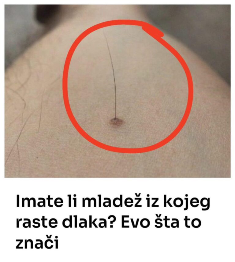 IMATE MLADEŽ IZ KOJEG RASTE DLAKA? Evo ŠTA TO ZAPRAVO ZNAČI I KADA JE POTREBNO BRINUTI!