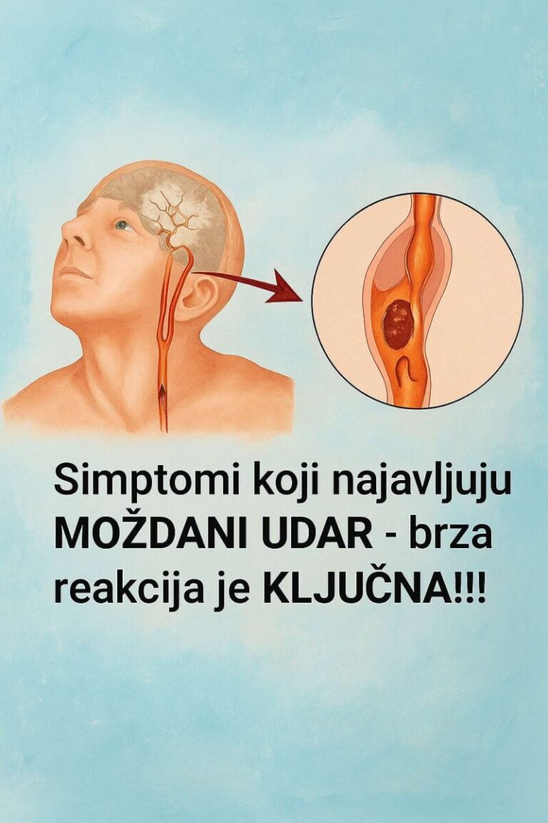 Moždani udar simptomi i oporavak