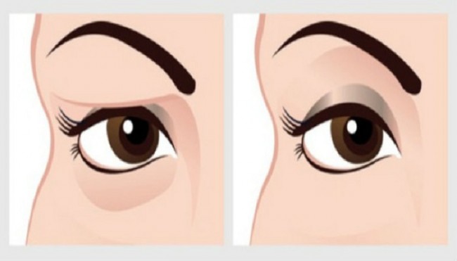 SNAŽAN LIJEK ZA VAŠE SPUŠTENE KAPKE – Vidjet’ Ćete Rezultate U Samo 2 Minute!