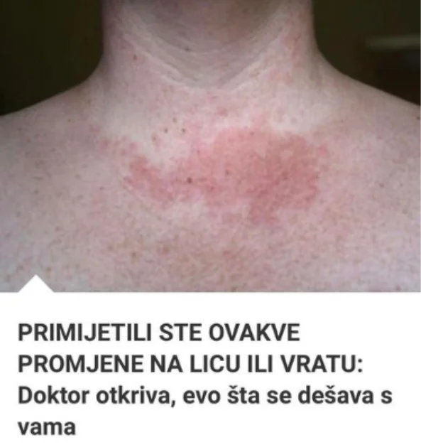 Primijećujete li ove promjene na svom licu ili vratu: Poznati doktor otkrio šta vam se dešava! (FOTO)