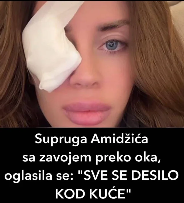Supruga Amidžića sa zavojem preko oka, oglasila se: „SVE SE DESILO KOD KUĆE“