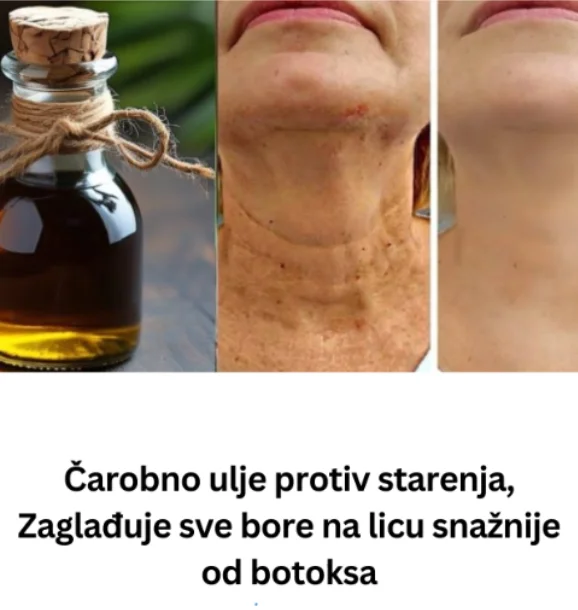 Čarobno ulje protiv starenja, Zaglađuje sve bore na licu snažnije od botoksa