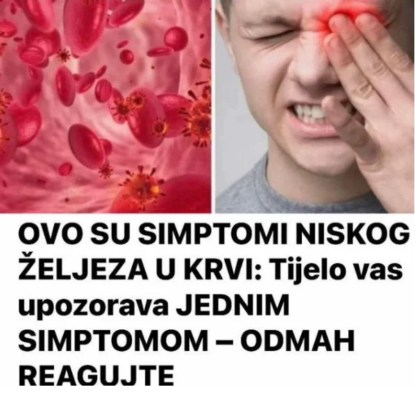 OVO SU SIMPTOMI NISKOG ŽELJEZA U KRVI: Tijelo vas upozorava JEDNIM SIMPTOMOM – ODMAH REAGUJTE
