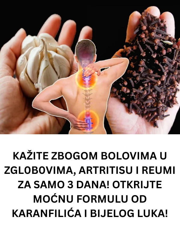 KAŽITE ZBOGOM BOLOVIMA U ZGL0B0VIMA, ARTRITISU I REUMI ZA SAMO 3 DANA! OTKRIJTE MOĆNU FORMULU OD KARANFILIĆA I BIJELOG LUKA!
