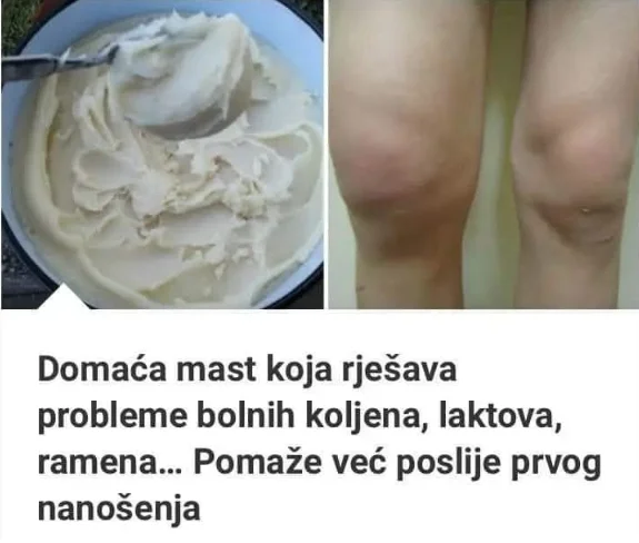 D0maća mast koja rješava probleme b0lnih koljena, laktova, ramena… Pomaže već posliije prvog nanošenja. (RECEPT)