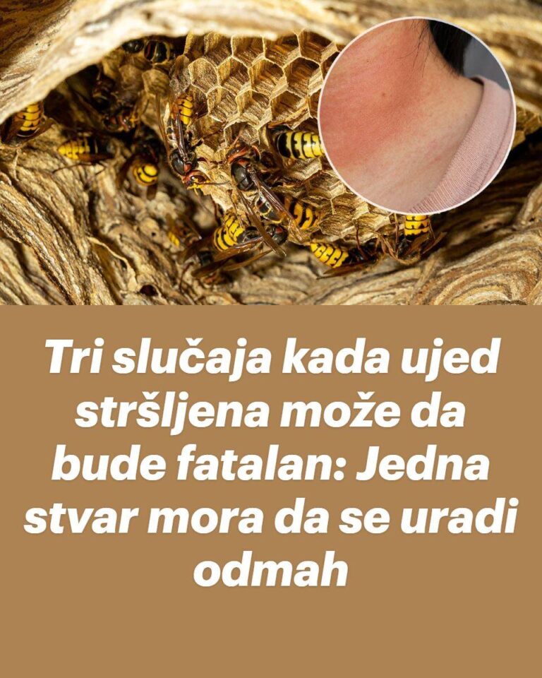 Tri slučaja kada ujed stršljena može da bude fatalan: Jedna stvar mora da se uradi odmah Zanimljivosti