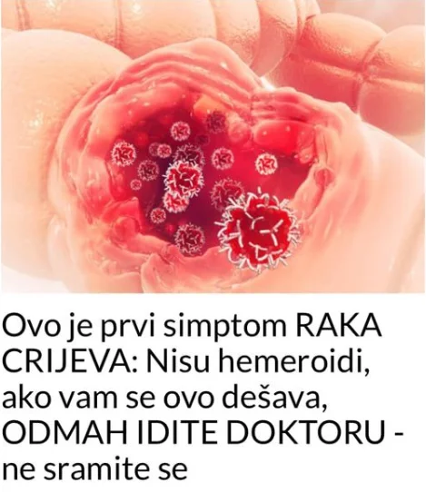 Ovo je prvi simptom RAKA CRIJEVA: Nisu hemeroidi, ako ovo primijetite, ODMAH IDITE DOKTORU – ne sramite se