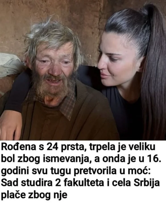 Rođena s 24 prsta, trpela je veliku bol zbog ismevanja, a onda je u 16. godini svu tugu pretvorila u moć: Sad studira 2 fakulteta i cela Srbija plače zbog nje