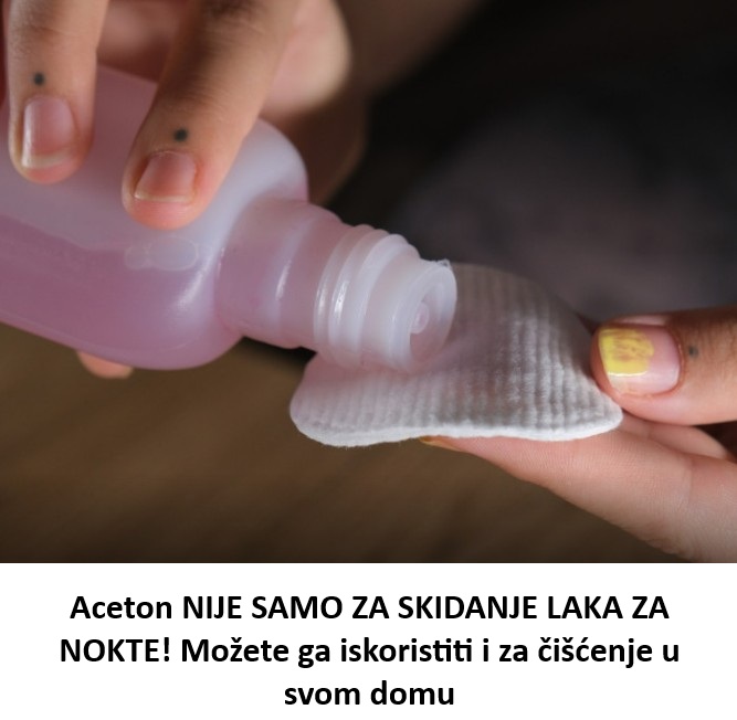 Aceton nije samo za nokte: Skida tvrdokorne mrlje kao od šale