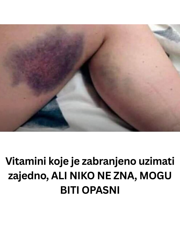 Vitamini koje je zabranjeno uzimati zajedno, ALI NIKO NE ZNA, MOGU BITI OPASNI