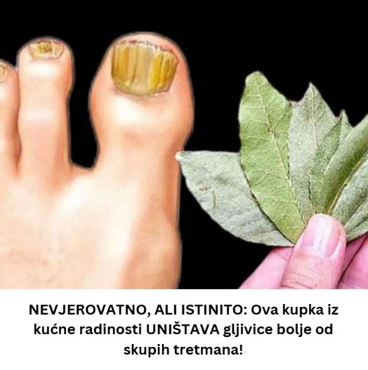 NEVJEROVATNO, ALI ISTINITO: Ova kupka iz kućne radinosti UNIŠTAVA gljivice bolje od skupih tretmana!