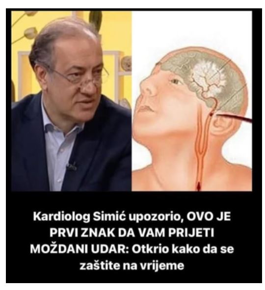 Kardiolog Simić upozorio, OVO JE PRVI ZNAK DA VAM PRIJETI MOŽDANI UDAR: Otkrio kako da se zaštite na vrijeme