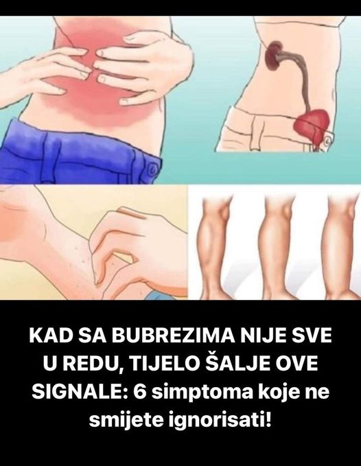 KAD SA BUBREZIMA NIJE SVE UREDU, TIJELO ŠALJE OVE SIGNALE: 6 simptoma koje ne smijete ignorisati