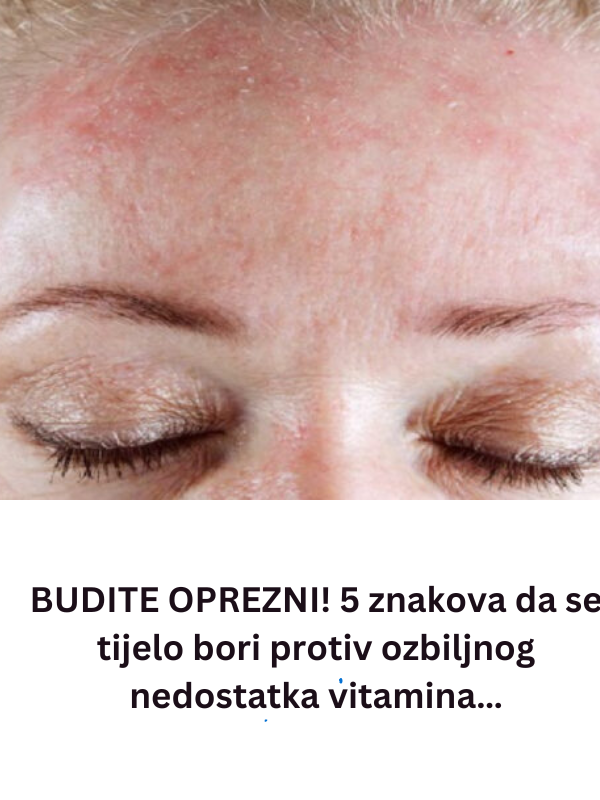 BUDITE OPREZNI! 5 znakova da se tijelo bori protiv ozbiljnog nedostatka vitamina…
