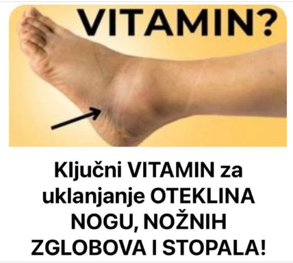 Ključni VITAMIN za uklanjanje OTEKLINA NOGU, NOŽNIH ZGLOBOVA I STOPALA!