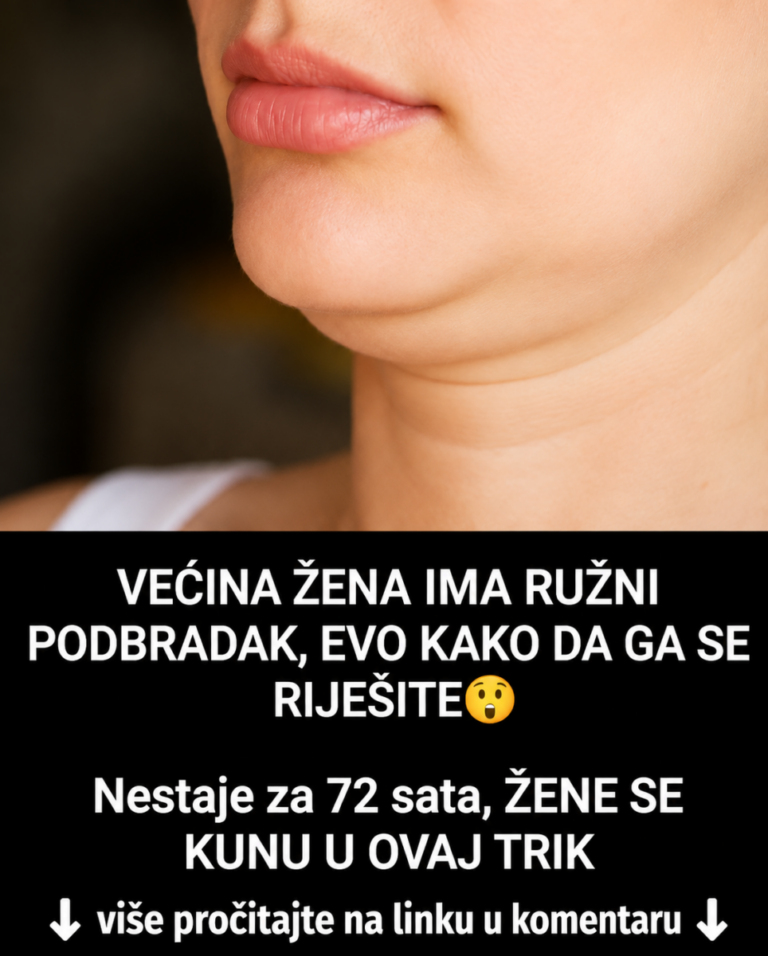 VEĆINA ŽENA IMA RUŽNI PODBRADAK, EVO KAKO DA GA SE RIJEŠITE: Nestaje za 72 sata, ŽENE SEKUNU U OVAJ TRIK