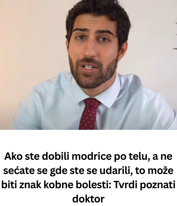 Ako ste dobili modrice po telu, a ne sećate se gde ste se udarili, to može biti znak kobne bolesti: Tvrdi poznati doktor