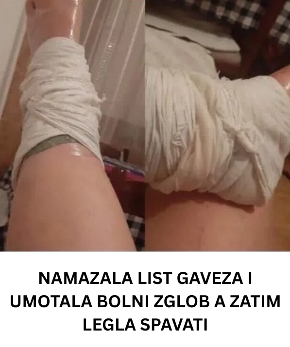 NAMAZALA LIST GAVEZA I UMOTALA BOLNI ZGLOB A ZATIM LEGLA SPAVATI