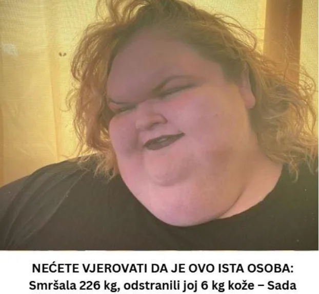NEĆETE VJEROVATI DA JE OVO ISTA OSOBA: Smršala 226 kg, odstranili joj 6 kg kože – Sada pozira u CRNOM VEŠU i ostavlja bez daha! (FOTO)