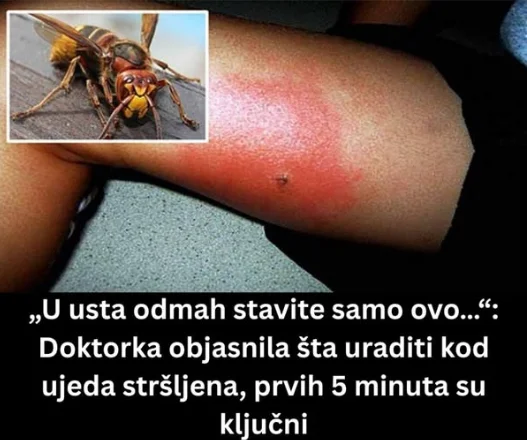 „U usta odmah stavite samo ovo…“: Doktorka objasnila šta uraditi kod ujeda stršljena, prvih 5 minuta su ključni