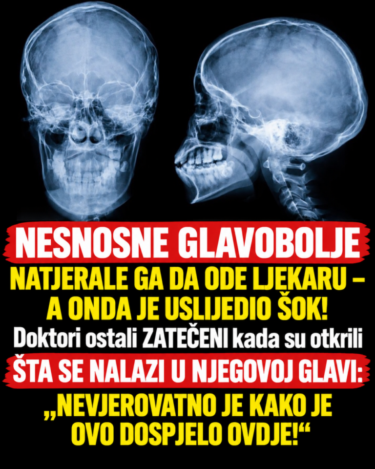 NESNOSNE GLAVOBOLJE NATJERALE GA DA ODE LJEKARU – A ONDA JE USLIJEDIO ŠOK! Doktori ostali ZATEČENI kada su otkrili ŠTA SE NALAZI U NJEGOVOJ GLAVI: „NEVJEROVATNO JE KAKO JE OVO DOSPJELO OVDJE!“