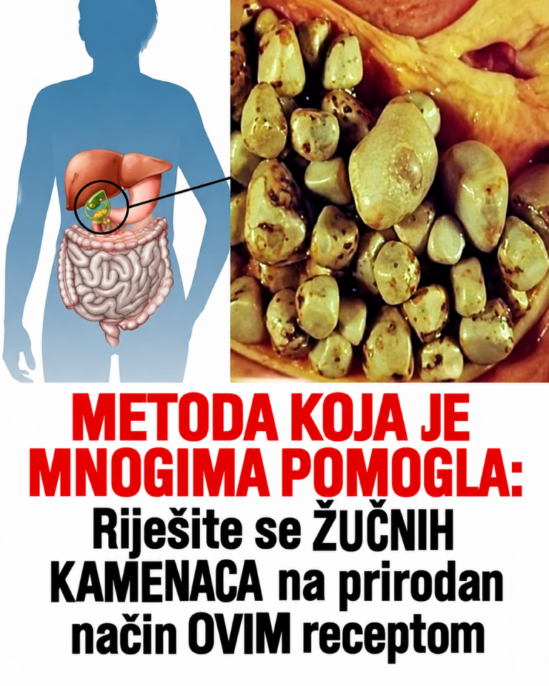 METODA KOJA JE MNOGIMA POMOGLA: Riješite se ŽUČNIH KAMENACA na prirodan način OVIM receptom