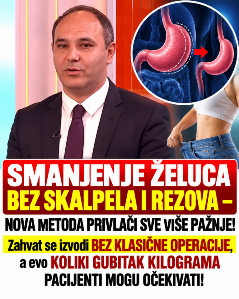 SMANJENJE ŽELUCA BEZ SKALPELA I REZOVA – NOVA METODA PRIVLAČI SVE VIŠE PAŽNJE! Zahvat se izvodi BEZ KLASIČNE OPERACIJE, a evo KOLIKI GUBITAK KILOGRAMA PACIJENTI MOGU OČEKIVATI!
